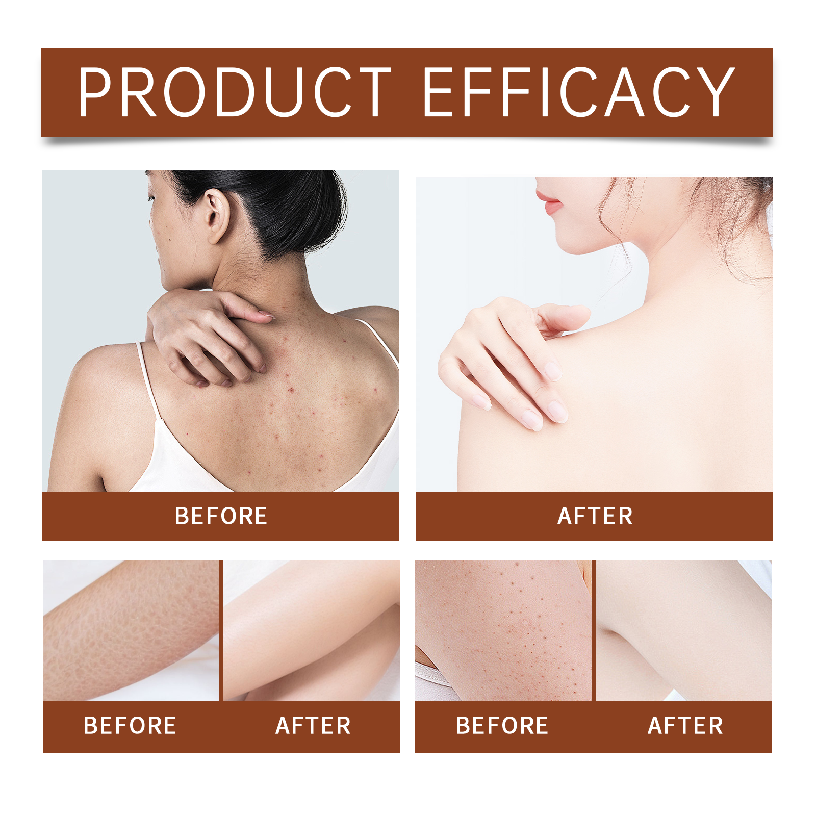 Luxury Body Oil for Dry Skin A - Luxury Skincare Cream ulasan dan harga